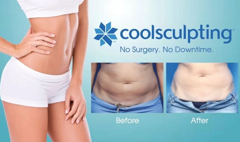 What are the Different Types of Coolsculpting Las Vegas Las Vegas